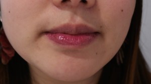 B Persistent Closeup