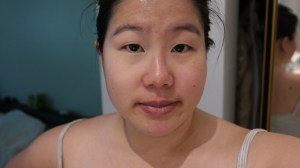 Remedy Concealer Pen on left side of eyelid and under eye 